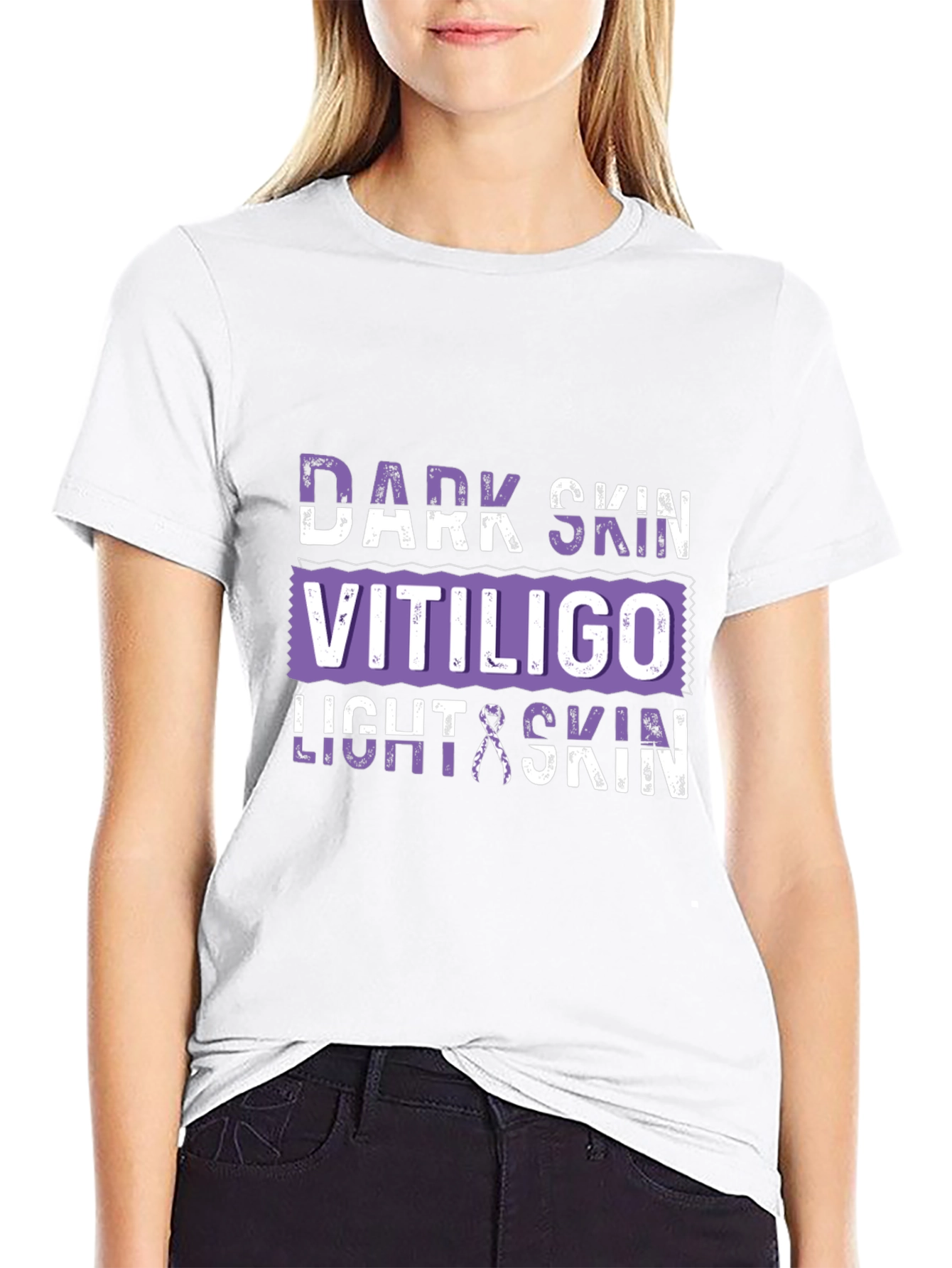 Vitiligo Awareness T-Shirt
